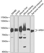 APEH Antibody in Western Blot (WB)