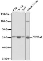 CYP51A1 Antibody in Western Blot (WB)