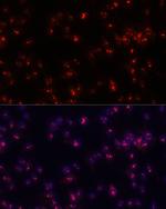 Fibrillarin Antibody in Immunocytochemistry (ICC/IF)