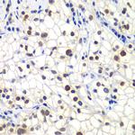 GTF2F2 Antibody in Immunohistochemistry (Paraffin) (IHC (P))