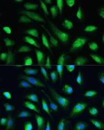 Galectin 3 Polyclonal Antibody