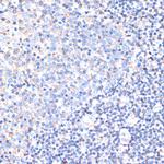 CD44 Antibody in Immunohistochemistry (Paraffin) (IHC (P))
