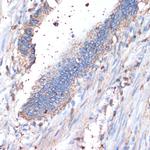 CD44 Antibody in Immunohistochemistry (Paraffin) (IHC (P))