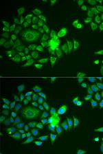 NDUFS4 Polyclonal Antibody