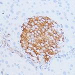 NOTCH3 Polyclonal Antibody