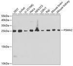 PSMA2 Polyclonal Antibody