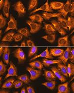 RPS3 Antibody in Immunocytochemistry (ICC/IF)