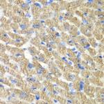 FIBP Antibody in Immunohistochemistry (Paraffin) (IHC (P))