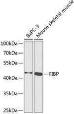 FIBP Antibody in Western Blot (WB)