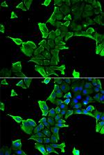 NCS1 Polyclonal Antibody