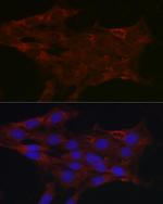 UGT1A1 Antibody in Immunocytochemistry (ICC/IF)