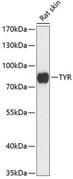 Tyrosinase Polyclonal Antibody