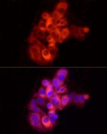 Albumin Polyclonal Antibody