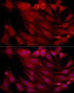 PSMB2 Polyclonal Antibody