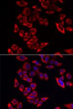 RPL9 Polyclonal Antibody