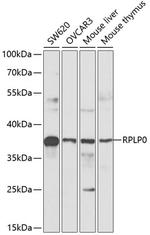 RPLP0 Antibody in Western Blot (WB)