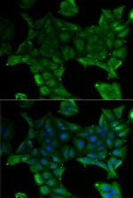 SLC34A1 Antibody in Immunocytochemistry (ICC/IF)