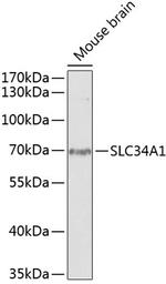 SLC34A1 Antibody in Western Blot (WB)