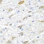 CPA6 Antibody in Immunohistochemistry (Paraffin) (IHC (P))