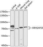 ARHGAP25 Antibody in Western Blot (WB)