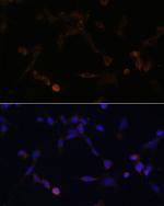 UBE2L6 Polyclonal Antibody