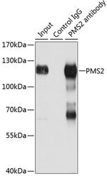 PMS2 Antibody in Immunoprecipitation (IP)