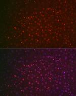 NR5A2 Antibody in Immunocytochemistry (ICC/IF)