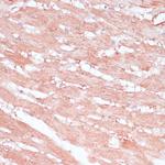 RPL30 Antibody in Immunohistochemistry (Paraffin) (IHC (P))