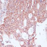 RPL30 Antibody in Immunohistochemistry (Paraffin) (IHC (P))