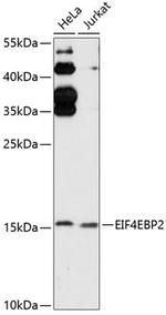 4E-BP2 Polyclonal Antibody