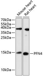Profilin 4 Polyclonal Antibody