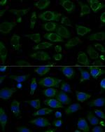 NDUFB7 Polyclonal Antibody