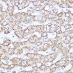 NDUFB7 Antibody in Immunohistochemistry (Paraffin) (IHC (P))