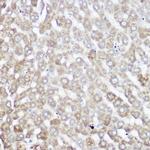 NDUFB7 Antibody in Immunohistochemistry (Paraffin) (IHC (P))