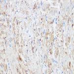 NDUFB7 Antibody in Immunohistochemistry (Paraffin) (IHC (P))