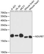 NDUFB7 Antibody in Western Blot (WB)