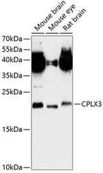 CPLX3 Polyclonal Antibody