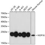 NOP16 Antibody in Western Blot (WB)