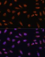 SARNP Polyclonal Antibody