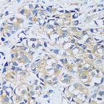 CABP7 Polyclonal Antibody