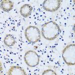 CABP7 Antibody in Immunohistochemistry (Paraffin) (IHC (P))