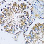 CABP7 Antibody in Immunohistochemistry (Paraffin) (IHC (P))
