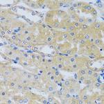 CABP7 Antibody in Immunohistochemistry (Paraffin) (IHC (P))