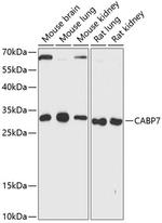 CABP7 Antibody in Western Blot (WB)