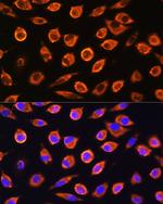 RND1 Polyclonal Antibody