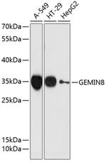 GEMIN8 Polyclonal Antibody