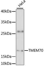 TMEM70 Polyclonal Antibody