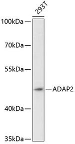 Centaurin alpha-2 Antibody in Western Blot (WB)