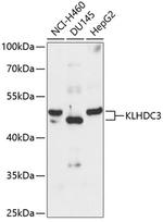 KLDC3 Polyclonal Antibody