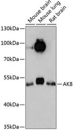Adenylate Kinase 8 Polyclonal Antibody